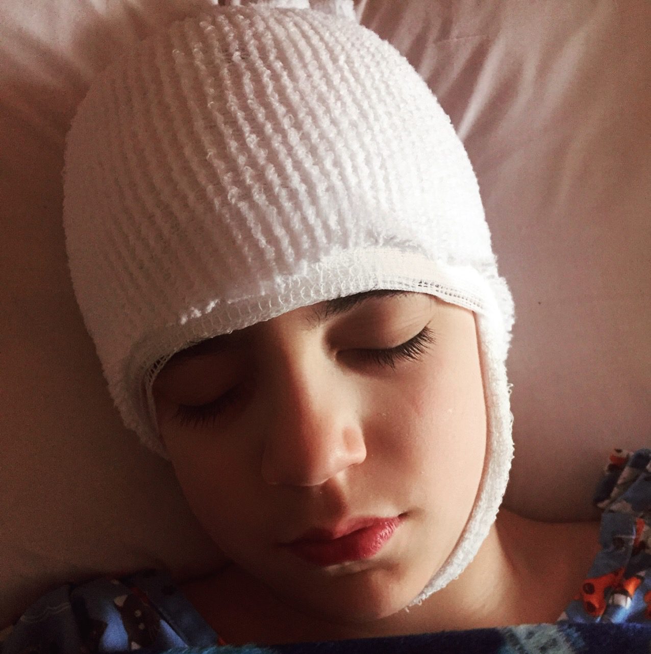 Logan Just out of surgery on March 30, 2017