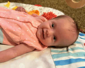 congenital hydrocephalus