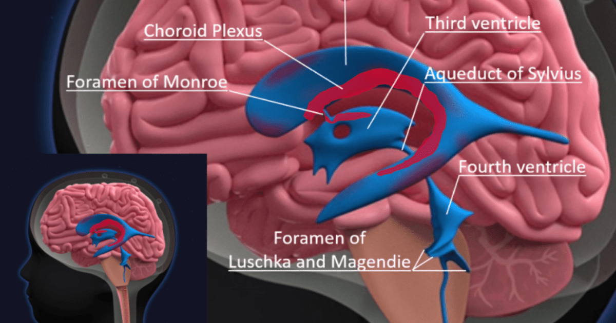 Cuanto cuesta un tac cerebral