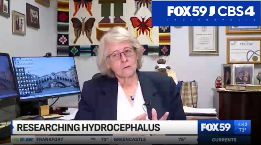 Hydrocephalus Research