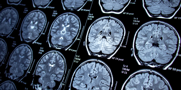 MRI Emerging Technology
